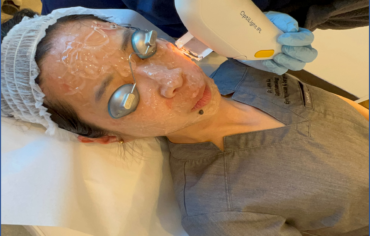 IPL Therapy: Rejuvenating Your Skin at a Staten Island Medical Office